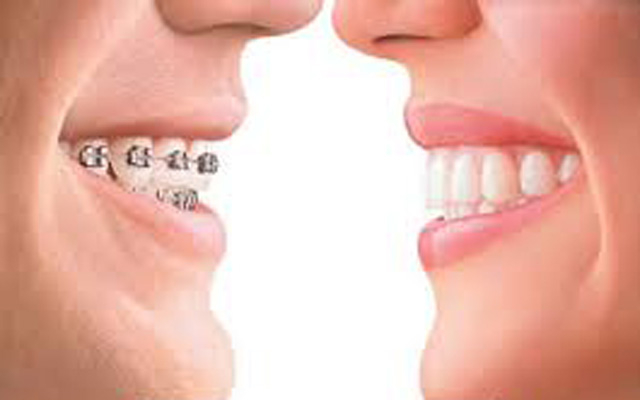 Nha Khoa Denta - Lê Văn Sỹ